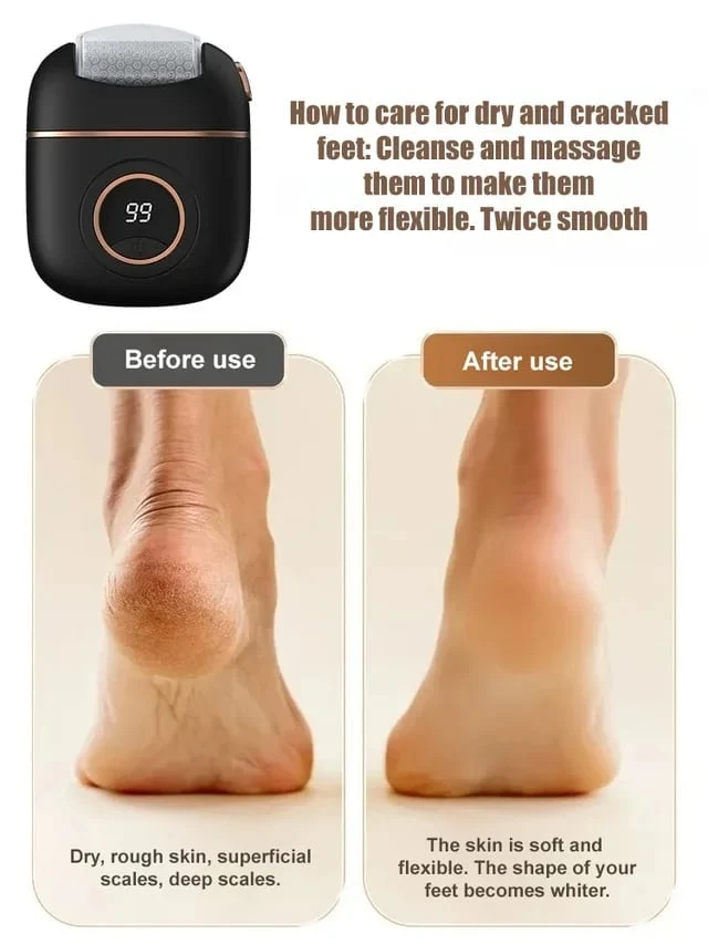 2025 New digital electric foot polishing machine - Image 4
