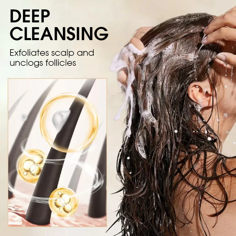 Anti-Dandruff Oil Control Shampoo - Image 2