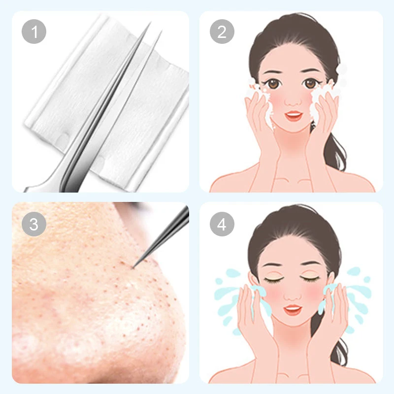💓Last day discount💥Medical grade blackhead cell clip tool set - Image 7
