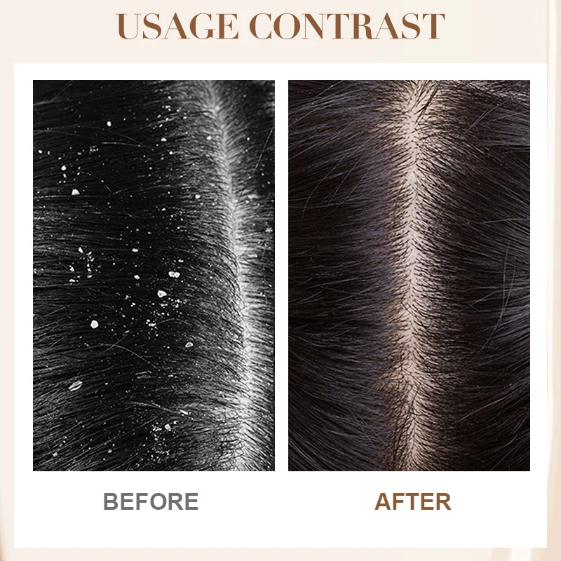 Dandruff Control & Soothing Shampoo - Image 3