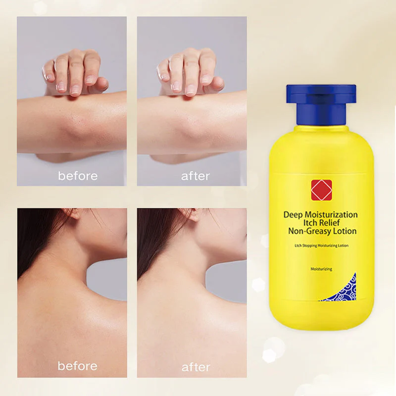 Deep Moisturization Itch Relief Non-Greasy Lotion - Image 5