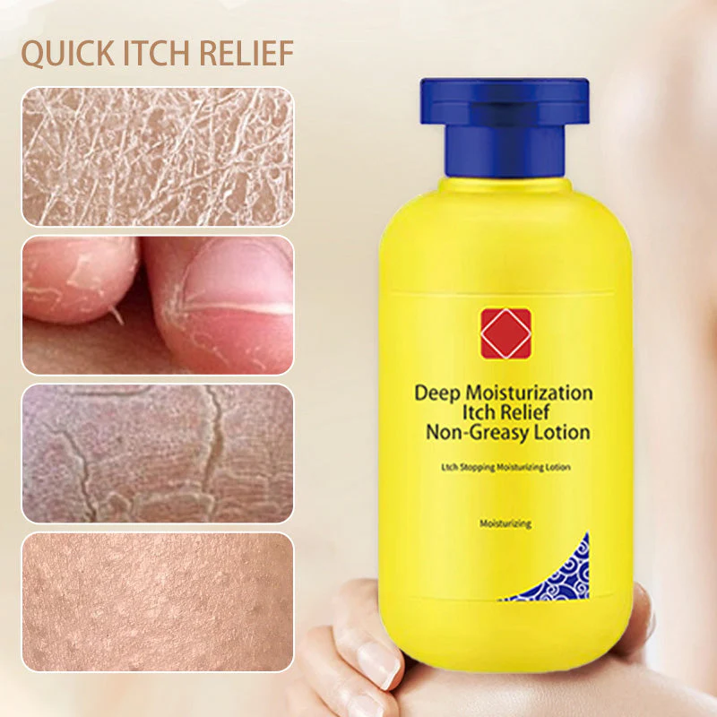 Deep Moisturization Itch Relief Non-Greasy Lotion - Image 6