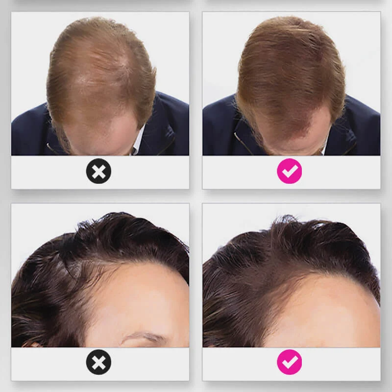 🔥Limited time 50% off sale🔥Hair Thickening Hair Building Fiber Powder - Image 2