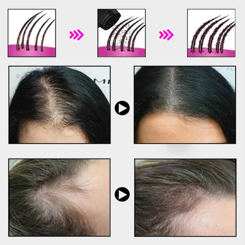 🔥Limited time 50% off sale🔥Hair Thickening Hair Building Fiber Powder - Image 3