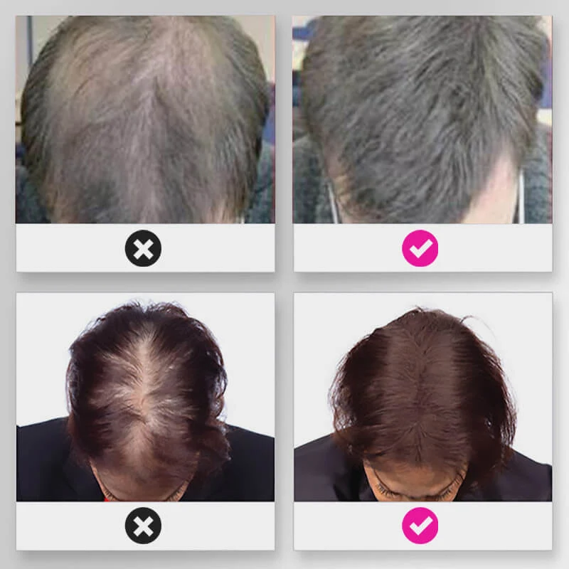 🔥Limited time 50% off sale🔥Hair Thickening Hair Building Fiber Powder - Image 5