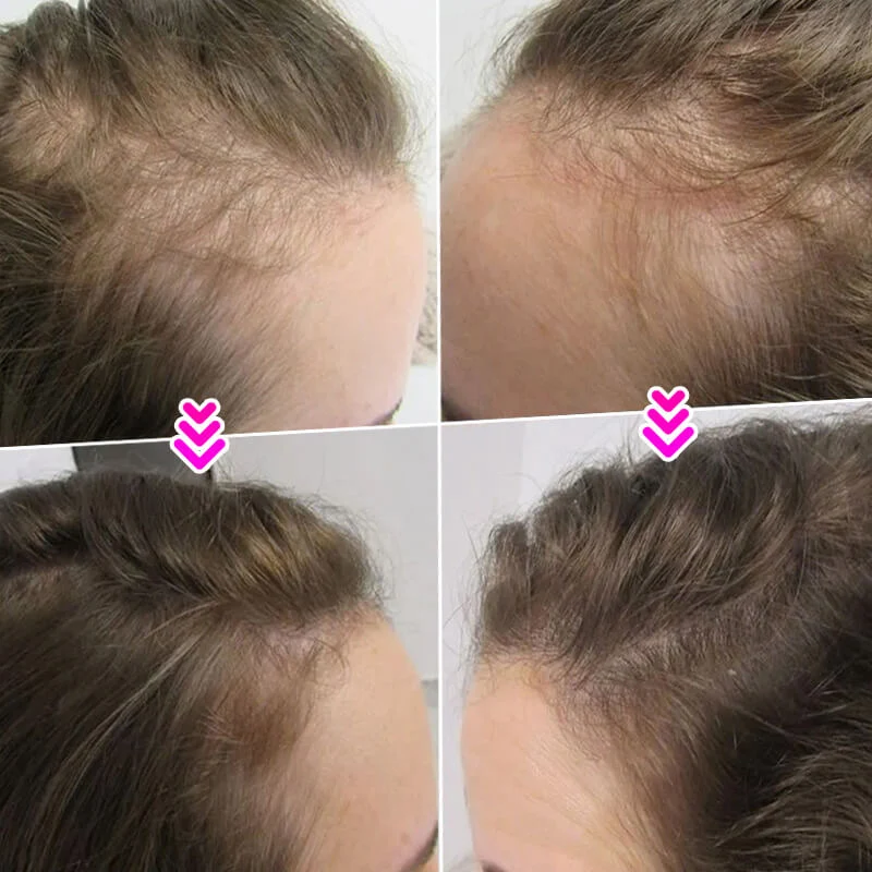 🔥Limited time 50% off sale🔥Hair Thickening Hair Building Fiber Powder - Image 6