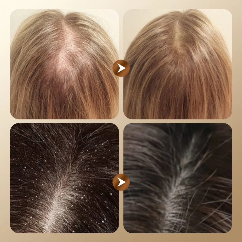 Herbal Hair Loss Prevention and Hair Growth Shampoo - Image 4
