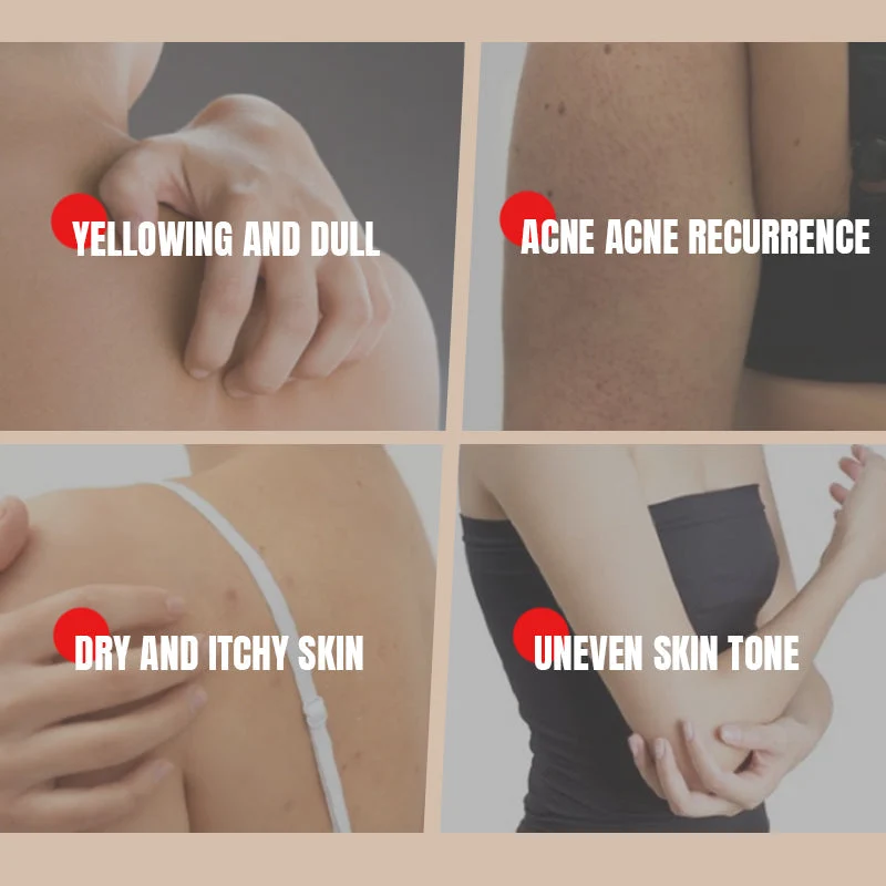 Deep Cleansing Moisturizing Sulfur Body Wash - Image 7