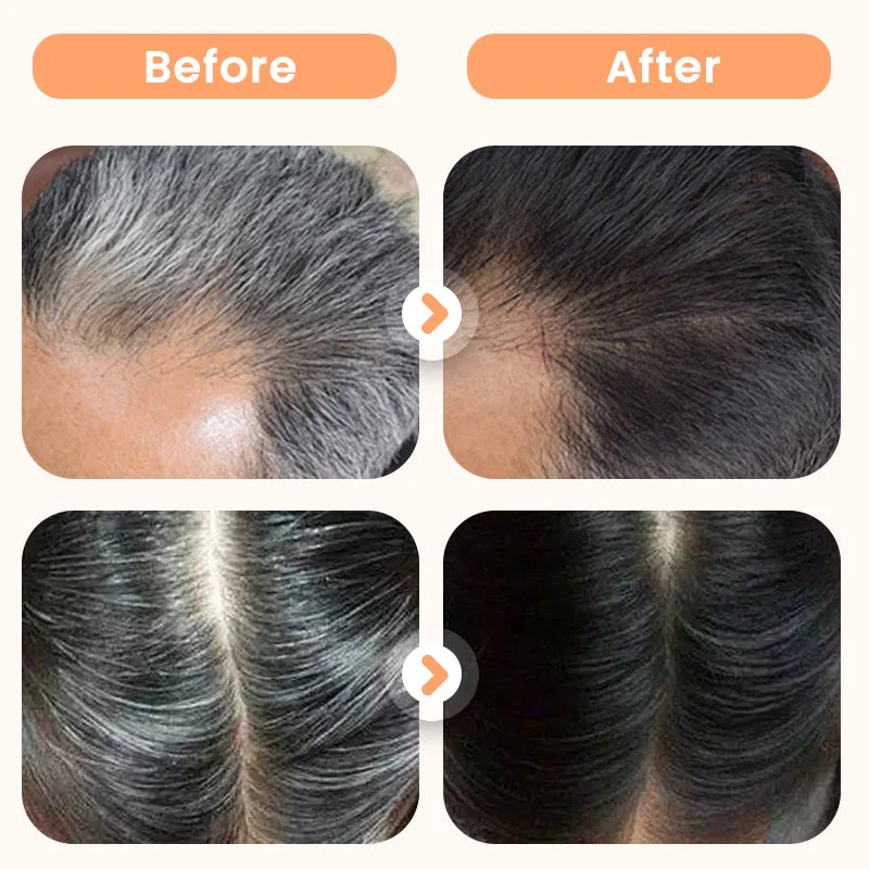 💆‍♀️🌿Plant Extract Hair Dye for Gray Hair - Image 4