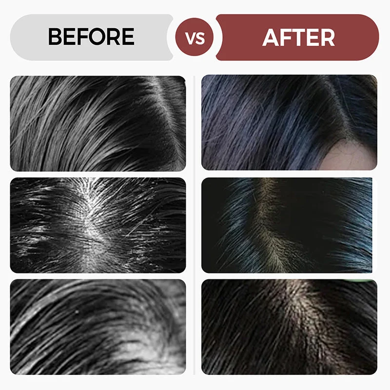 💥Now on sale around the world🔥Newly Developed Deep Moisturizing Conditioner⏲️Limited time offer buy more get more free - Image 4